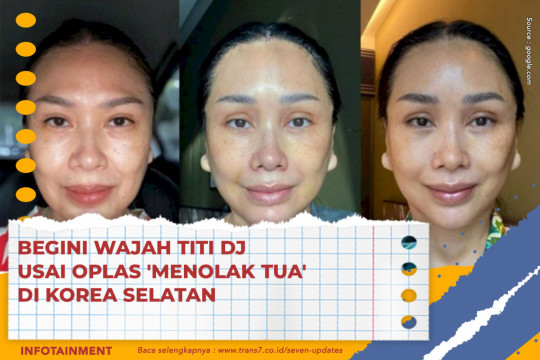 Begini Wajah Titi Dj Usai Oplas 'Menolak Tua' Di Korea Selatan