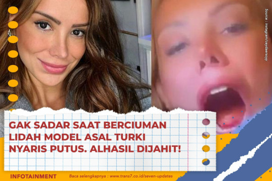 Gak Sadar Saat Berciuman Lidah Model Asal Turki Nyaris Putus. Alhasil Dijahit!