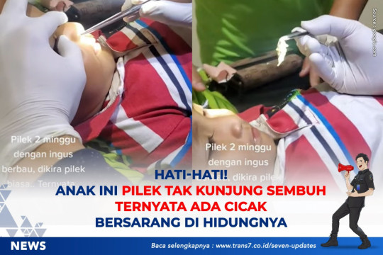 Hati-hati! Anak Ini Pilek Tak Kunjung Sembuh Ternyata Ada Cicak Bersarang Di Hidungnya