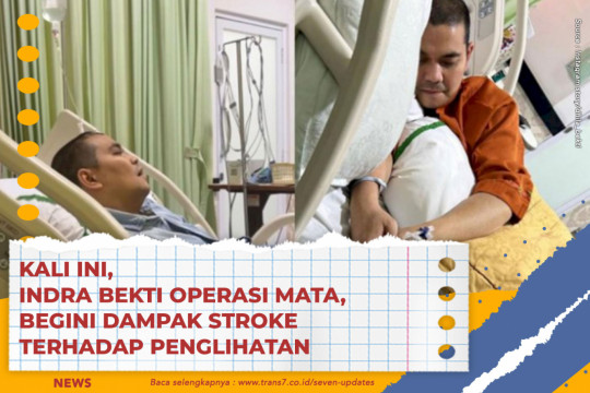 Kali Ini Indra Bekti Operasi Mata, Begini Dampak Stroke Terhadap Penglihatan