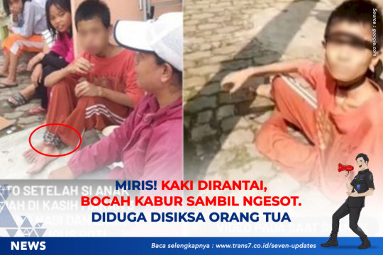 Miris! Kaki Dirantai, Bocah Kabur Sambil Ngesot. Diduga Disiksa Orang Tua
