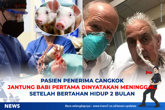 Pasien Penerima Cangkok Jantung Babi Pertama Dinyatakan Meninggal, Setelah Bertahan Hidup 2 Bulan