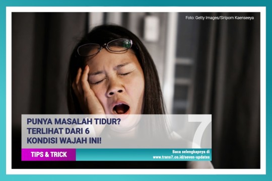 Punya Masalah Tidur? Terlihat Dari Kondisi Wajah!