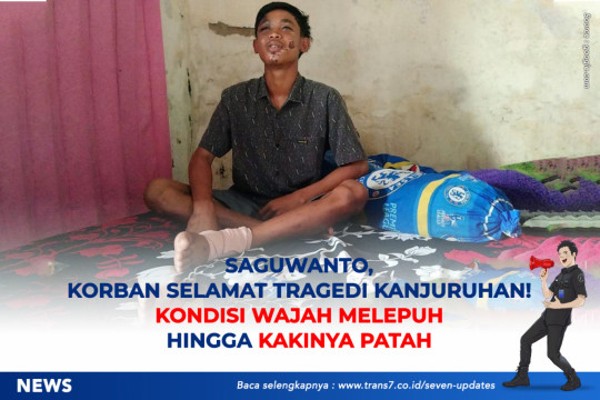 Saguwanto Korban Selamat Tragedi Kanjuruhan! Kondisi Wajah Melepuh Hingga Kakinya Patah